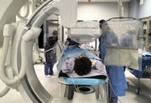 Photo of Olsztyn: Pierwsza w regionie operacja endowaskularnego zaopatrzenia żylaków jądra u dziecka